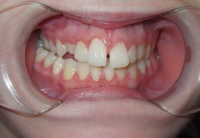 Bring Your Smile Back With Advanced Dentistry