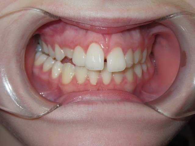 Bring Your Smile Back With Advanced Dentistry